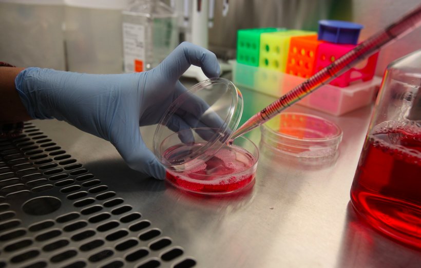UAB Stem Cell Institute could be on the verge of a cure for sickle cell disease. (Meg McKinney/Alabama NewsCenter)