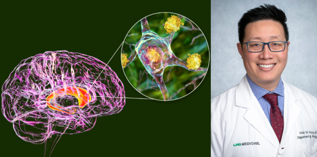 Huntington's Disease